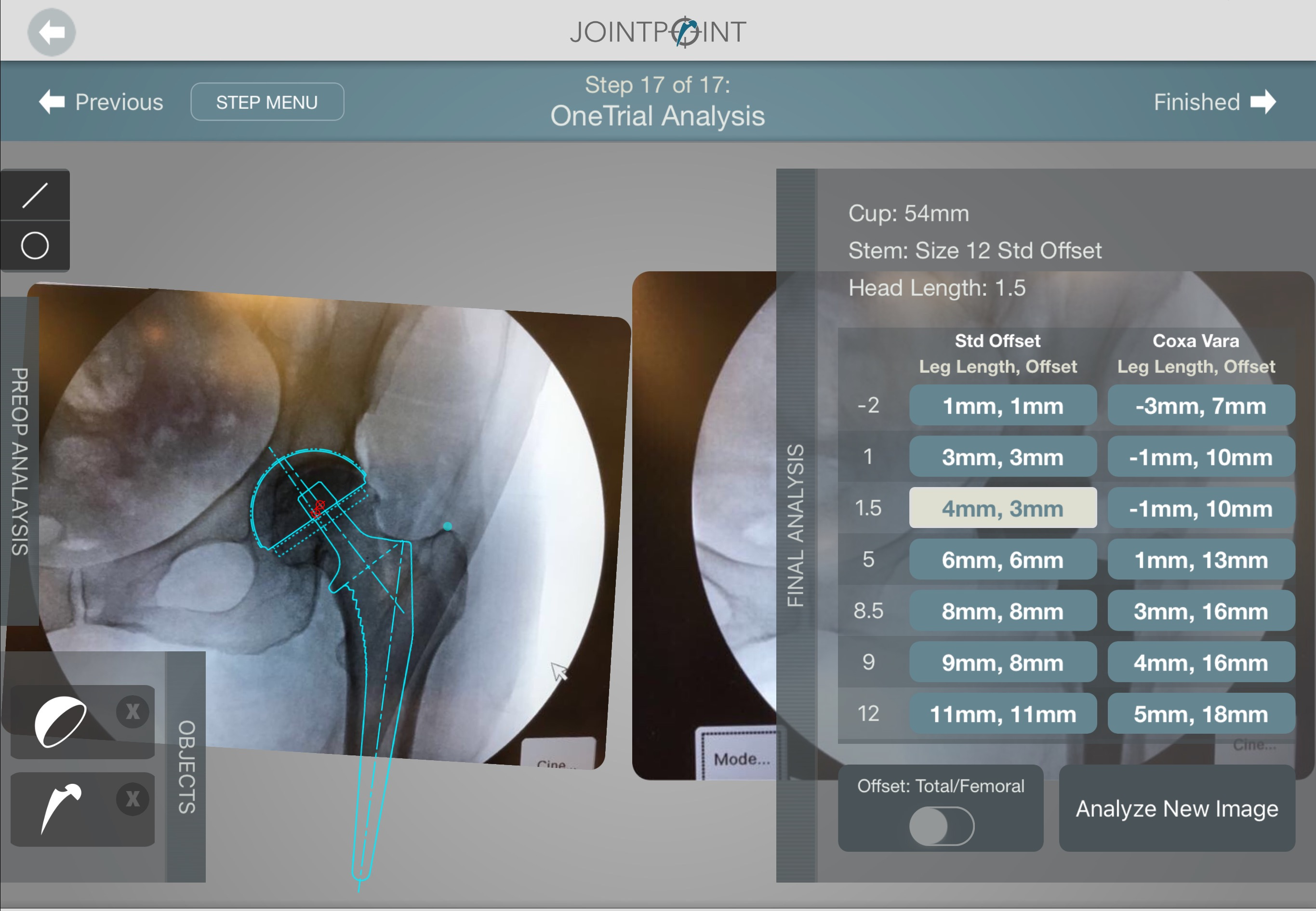 OneTrial Predicts Optimal Implant Combination